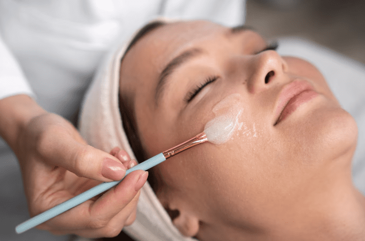 Chemický peeling